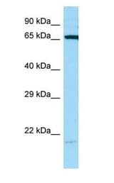 HSPA1B antibody Western Blot of MDA-MB-435S.