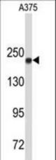 Western blot of TOP2A Antibody in A375 cell line lysates (35 ug/lane). TOP2A (arrow) was detected using the purified antibody.