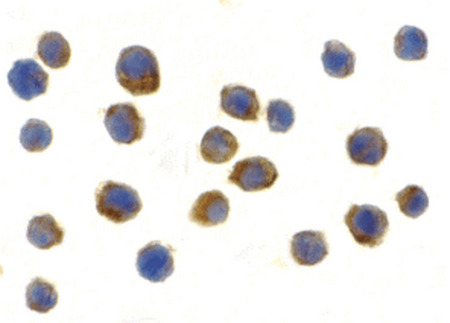Immunocytochemistry of TLR9 in Jurkat cells with TLR9antibody at 2 ug/ml.