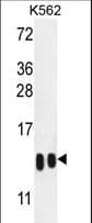 H4-K20 Antibody western blot of K562 cell line lysates (35 ug/lane). The H4 antibody detected the H4-K20(arrow). From left to right ,the Sample Lot# is SA090513AM?SA090513AN.