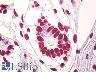 Anti-HnRNP U / p120 antibody IHC of human breast. Immunohistochemistry of formalin-fixed, paraffin-embedded tissue after heat-induced antigen retrieval. Antibody LS-B8035 dilution 10 ug/ml.