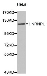 Western blot analysis of extracts of HeLa cell lines, using HNRNPU antibody.