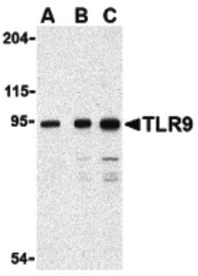 Western blot of TLR9 in Jurkat cell lysate with TLR9 antibody at (A) 0.5, (B) 1 and (C) 2 ug/ml.
