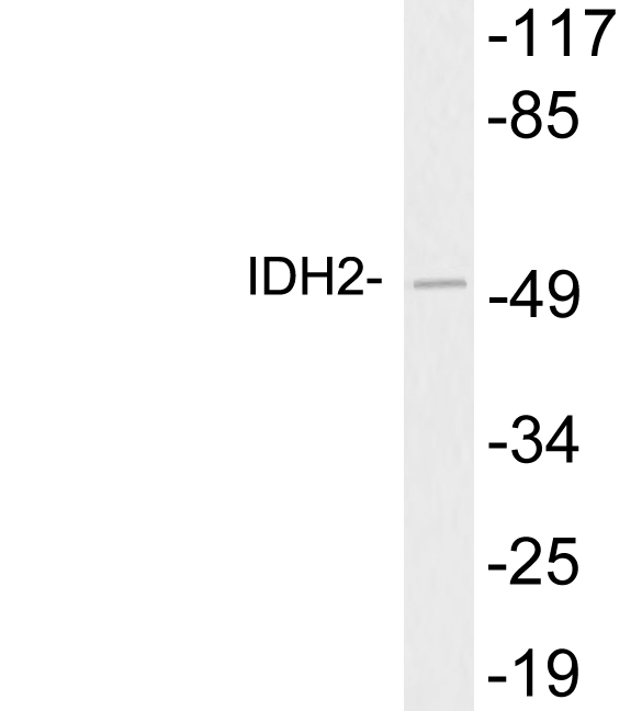 Western blot of extracts from Caki-1 cells, using IDH2 antibody.
