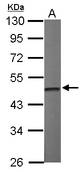 Sample (50 ug of whole cell lysate). A: Mouse brain. 10% SDS PAGE. IDH / IDH2 antibody diluted at 1:1000.