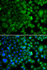 Immunofluorescence blot of U20S cell using IDH2 antibody. Blue: DAPI for nuclear staining.