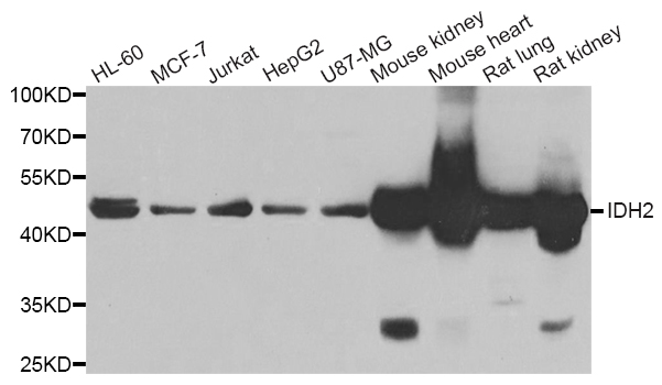 Western blot blot of extracts of various cell lines, using IDH2 antibody.