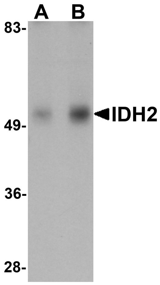 Western blot analysis of IDH2 in human heart tissue lysate with IDH2 antibody at (A) 1 and (B) 2 ug/ml.