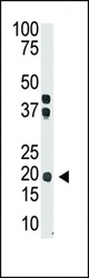 The anti-IL28 Ctr-term antibody is used in Western blot to detect IL28 in mouse brain tissue lysate.