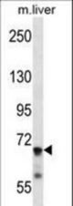IL1R1 Antibody western blot of mouse liver tissue lysates (35 ug/lane). The IL1R1 antibody detected the IL1R1 protein (arrow).