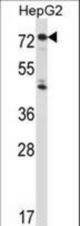 IL1R1 Antibody western blot of HepG2 cell line lysates (35 ug/lane). The IL1R1 antibody detected the IL1R1 protein (arrow).