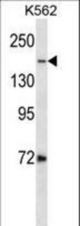 TOP2A/Topo? Antibody western blot of K562 cell line lysates (35 ug/lane). The TOP2A/Topo? antibody detected the TOP2A/Topo? protein (arrow).