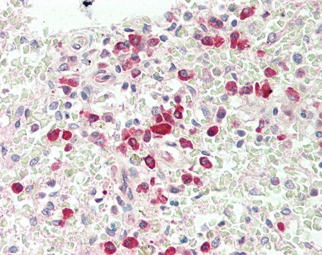 Human Spleen: Formalin-Fixed, Paraffin-Embedded (FFPE)