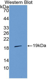 Western blot of recombinant IL36RN / IL1F5.