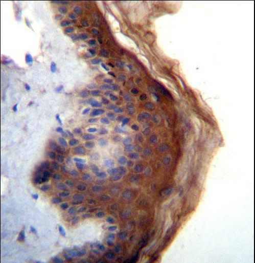 IL1F5 Antibody immunohistochemistry of formalin-fixed and paraffin-embedded human skin tissue followed by peroxidase-conjugated secondary antibody and DAB staining.