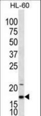 IL1F5 Antibody western blot of HL-60 cell line lysates (35 ug/lane). The IL1F5 antibody detected the IL1F5 protein (arrow).