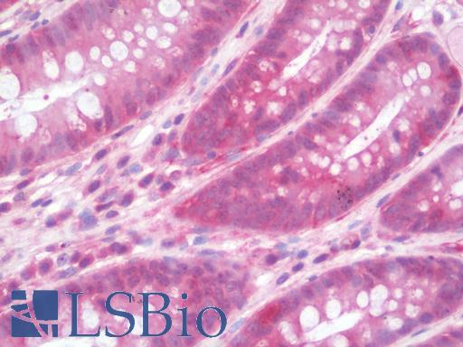 Anti-IL36RN / IL1F5 antibody IHC staining of human colon. Immunohistochemistry of formalin-fixed, paraffin-embedded tissue after heat-induced antigen retrieval. Antibody LS-B10137 concentration 10 ug/ml.