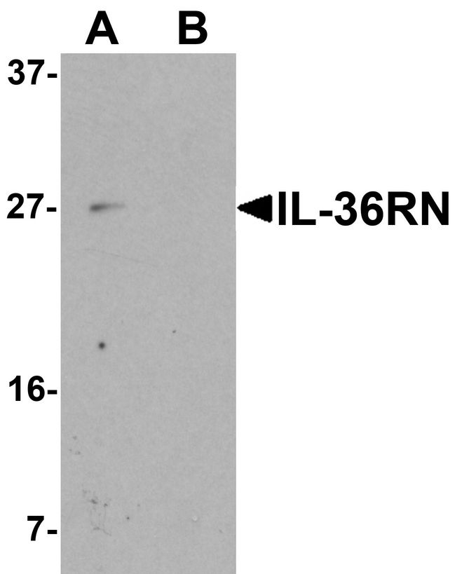 Western blot analysis of IL-36RN in 3T3 cell lysate with IL-36RN antibody at 1 ug/ml in (A) the absence and (B) the presence of blocking peptide.