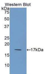 Western blot of recombinant IL1F5.