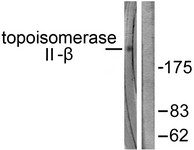 Western blot of extracts from Jurkat cells, using TOP2B Antibody. The lane on the right is treated with the synthesized peptide.
