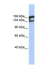 TOP2B antibody LS-C110235 Western blot of Jurkat lysate.