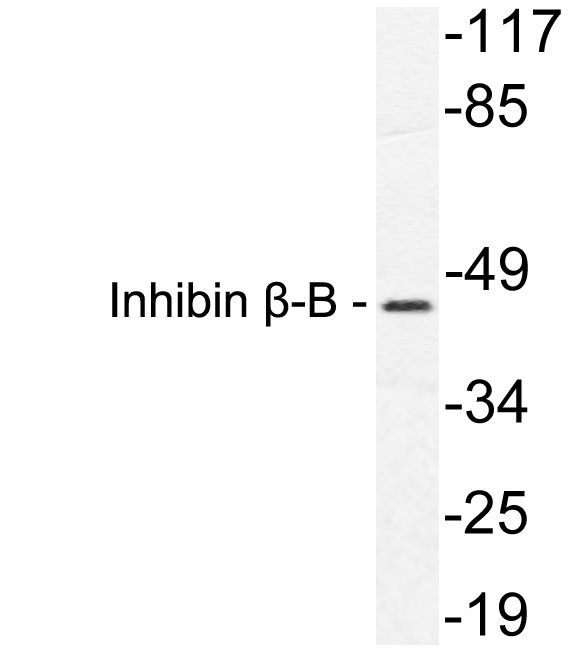 Western blot of Inhibin -B (P124) pAb in extracts from HeLa cells.