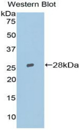Western blot of recombinant TOP2B / Topoisomerase II Beta.
