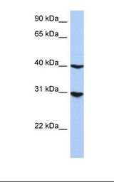 HepG2 cell lysate. Antibody concentration: 1.2 ug/ml. Gel concentration: 12%.