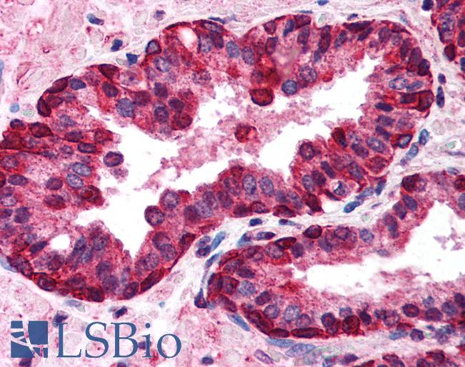Anti-IRF3 antibody IHC of human prostate. Immunohistochemistry of formalin-fixed, paraffin-embedded tissue after heat-induced antigen retrieval. Antibody LS-B135 concentration 10 ug/ml.