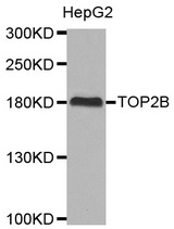 Western blot analysis of extracts of HepG2 cell line, using TOP2B antibody.