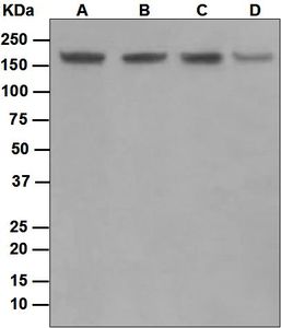Western blot analysis on (A) Jurkat, (B) K562, (C) Raw264.7, and (D) PC-12 cell lysates using anti-Topoisomerase II Beta antibody.