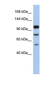 TLR9 antibody LS-C109765 Western blot of ACHN lysate.