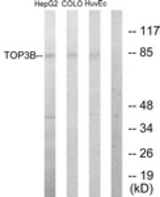 Western blot of extracts from HepG2/COLO205/HUVEC cells, using TOP3B Antibody. The lane on the right is treated with the synthesized peptide.