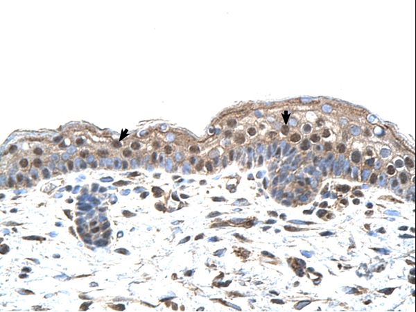 IRF4 antibody LS-C80182 was used in IHC to stain formalin-fixed, paraffin-embedded human skin.