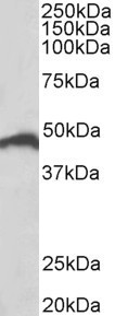 IRF4 antibody (0.5 ug/ml) staining of Jurkat lysate (35 ug protein in RIPA buffer). Primary incubation was 1 hour. Detected by chemiluminescence.