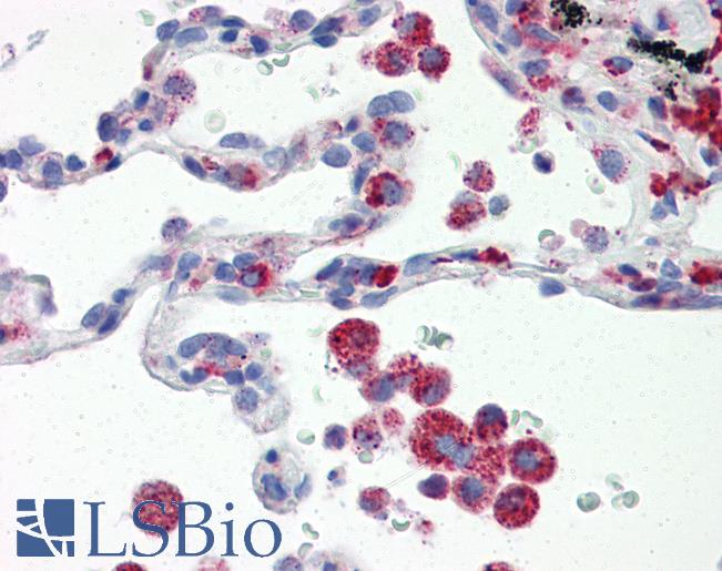 Anti-IRF7 antibody IHC of human lung. Immunohistochemistry of formalin-fixed, paraffin-embedded tissue after heat-induced antigen retrieval. Antibody LS-B2945 concentration 20 ug/ml.