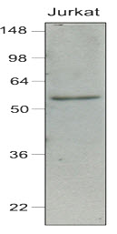 Cell lysates of Jurkat (40 ug) were resolved by SDS-PAGE, transferred to NC membrane and probed with anti-human IRF7 (1:1000). Proteins were visualized using a goat anti-mouse secondary antibody conjugated to HRP and an ECL detection system.