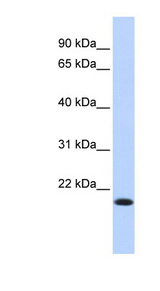 IRF7 antibody LS-C110267 Western blot of HeLa lysate.