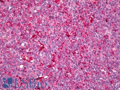 Anti-IRF7 antibody IHC of human thymus. Immunohistochemistry of formalin-fixed, paraffin-embedded tissue after heat-induced antigen retrieval. Antibody LS-B6550 dilution 1:100.