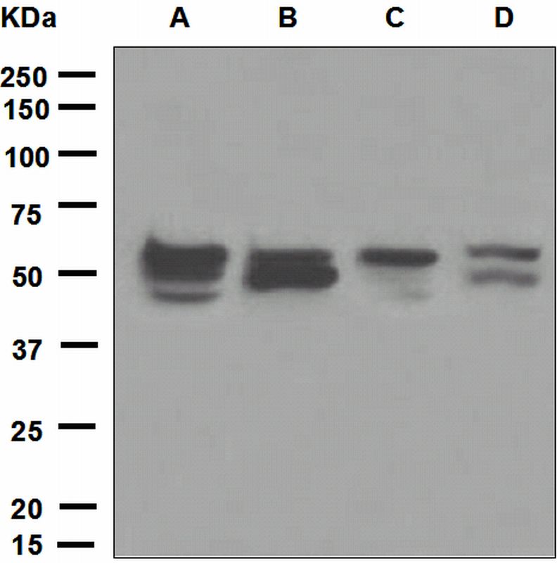 Western blot analysis on (A) Jurkat, (B) Raji, (C) HuT-78, and (D) Raw264.7 cell lysates using anti-IRF-7 antibody.