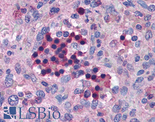 Anti-IRF7 antibody IHC of human spleen. Immunohistochemistry of formalin-fixed, paraffin-embedded tissue after heat-induced antigen retrieval. Antibody LS-B1372 concentration 5 ug/ml.