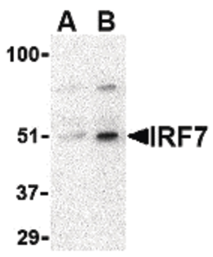 Western blot of IRF7 in 293 whole cell lysate with IRF7 antibody at (A) 0.5 and (B) 1 ug/ml.