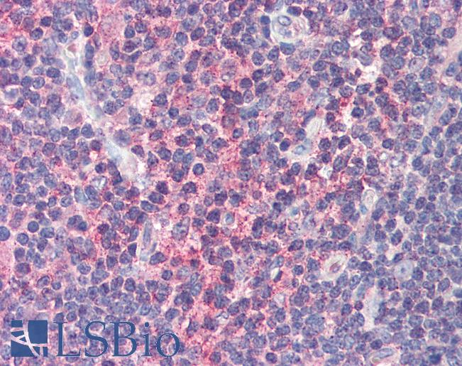Anti-IRF7 antibody IHC of human thymus. Immunohistochemistry of formalin-fixed, paraffin-embedded tissue after heat-induced antigen retrieval. Antibody LS-B577 concentration 5 ug/ml.