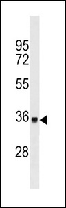 DYT1 Antibody western blot of ZR-75-1 cell line lysates (35 ug/lane). The DYT1 antibody detected the DYT1 protein (arrow).
