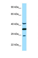 TOR1A / Torsin A antibody LS-C146485 Western blot of Fetal Brain lysate. Antibody concentration 1 ug/ml.