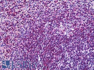Anti-ITGAL / CD11a antibody IHC of human spleen. Immunohistochemistry of formalin-fixed, paraffin-embedded tissue after heat-induced antigen retrieval. Antibody LS-B5915 concentration 3.75 ug/ml.
