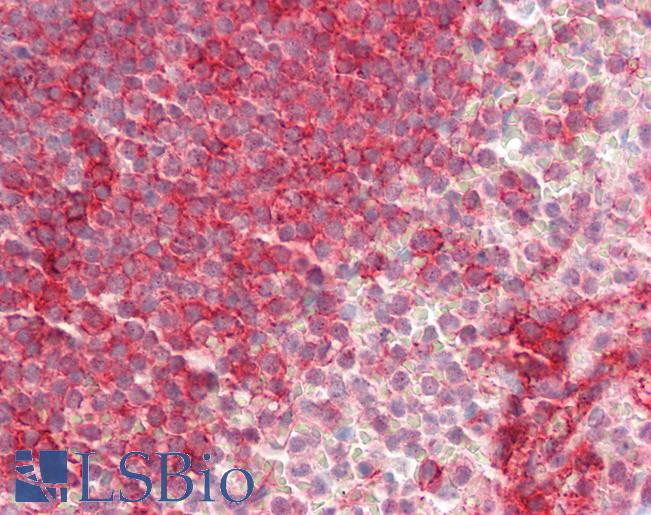 Anti-LFA-1 / CD11a antibody IHC staining of human spleen. Immunohistochemistry of formalin-fixed, paraffin-embedded tissue after heat-induced antigen retrieval. Antibody LS-B10681 dilution 1:100.