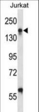 ITGAL Antibody western blot of Jurkat cell line lysates (35 ug/lane). The ITGAL antibody detected the ITGAL protein (arrow).