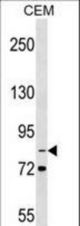 ITGB2 Antibody western blot of CEM cell line lysates (35 ug/lane). The ITGB2 antibody detected the ITGB2 protein (arrow).