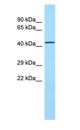 TOR1AIP2 antibody Western Blot of Fetal Lung.